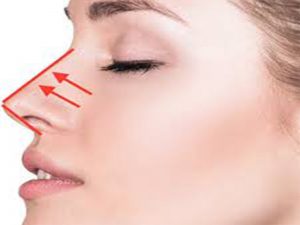 جراحة الاورام الحميدة